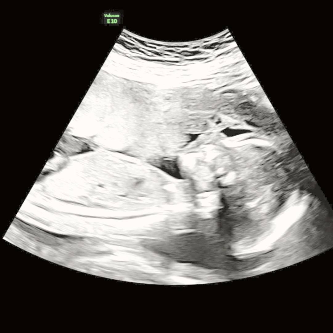 Photo shared by Samantha for their Babylist baby registry.