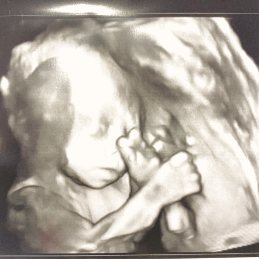 Photo shared by Kyla for their Babylist baby registry.