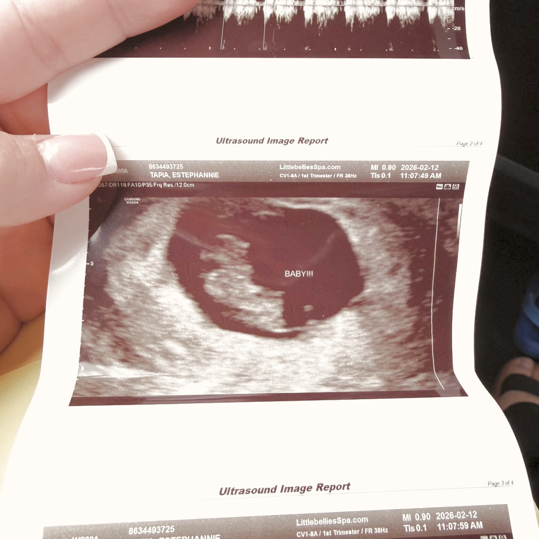 Photo shared by Estephannie for their Babylist baby registry.