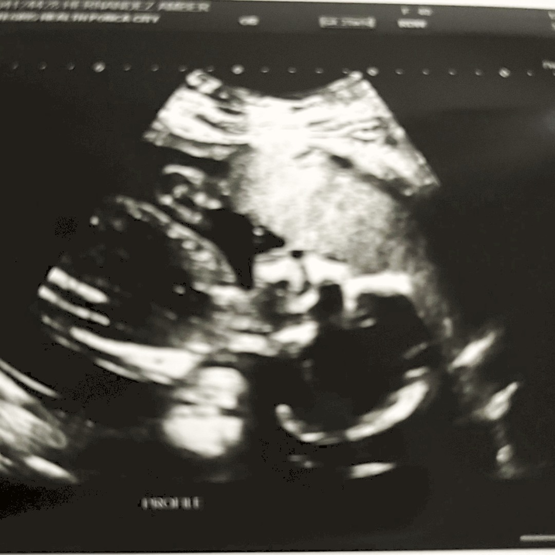 Photo shared by Amber for their Babylist baby registry.