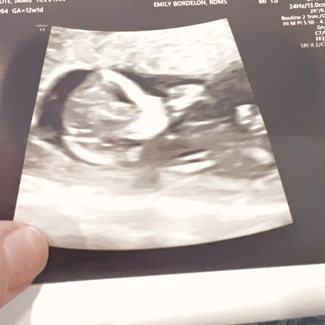 Photo shared by Jamie for their Babylist baby registry.