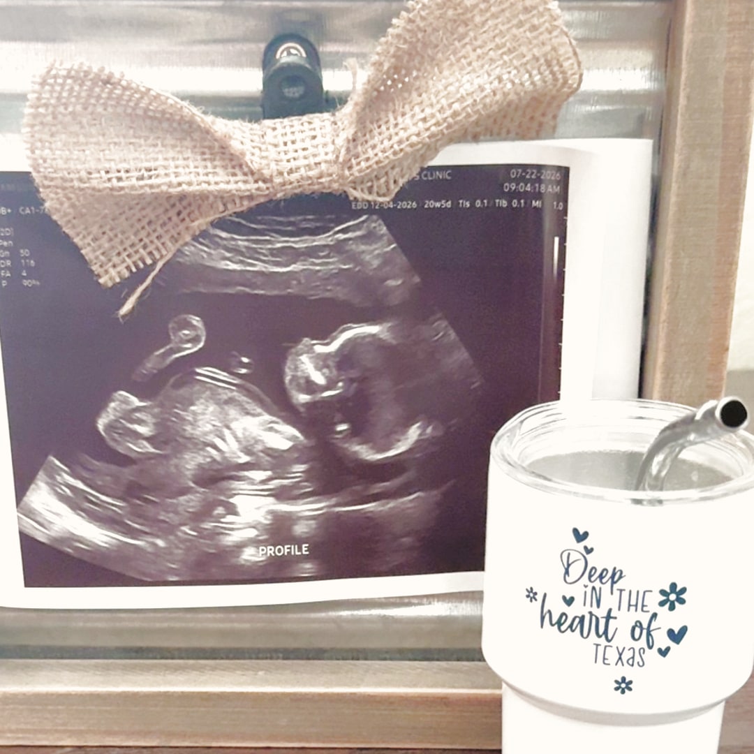 Photo shared by Madison for their Babylist baby registry.
