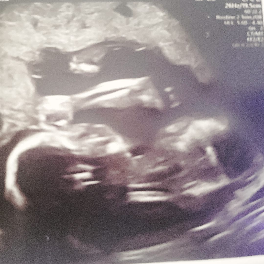 Photo shared by Samantha for their Babylist baby registry.