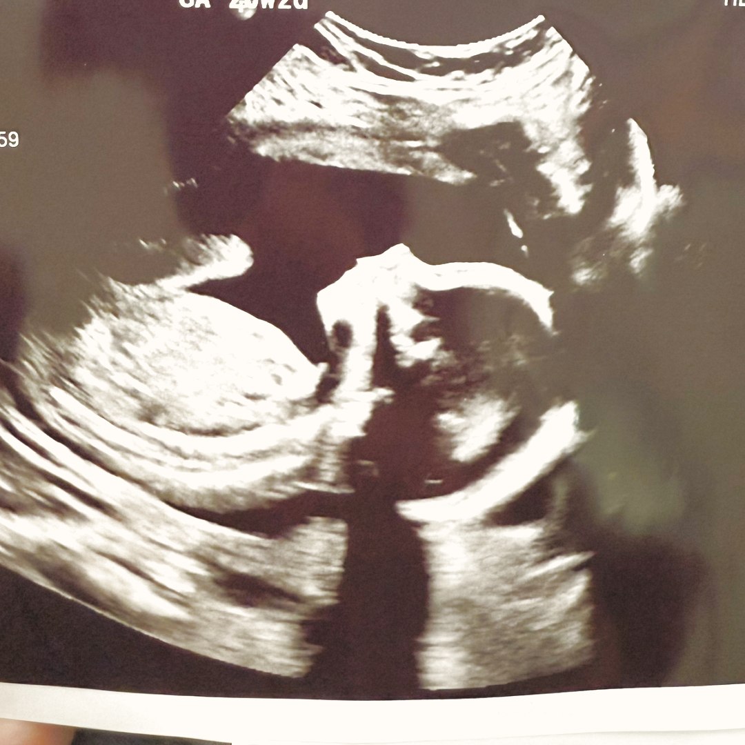 Photo shared by Maddie for their Babylist baby registry.