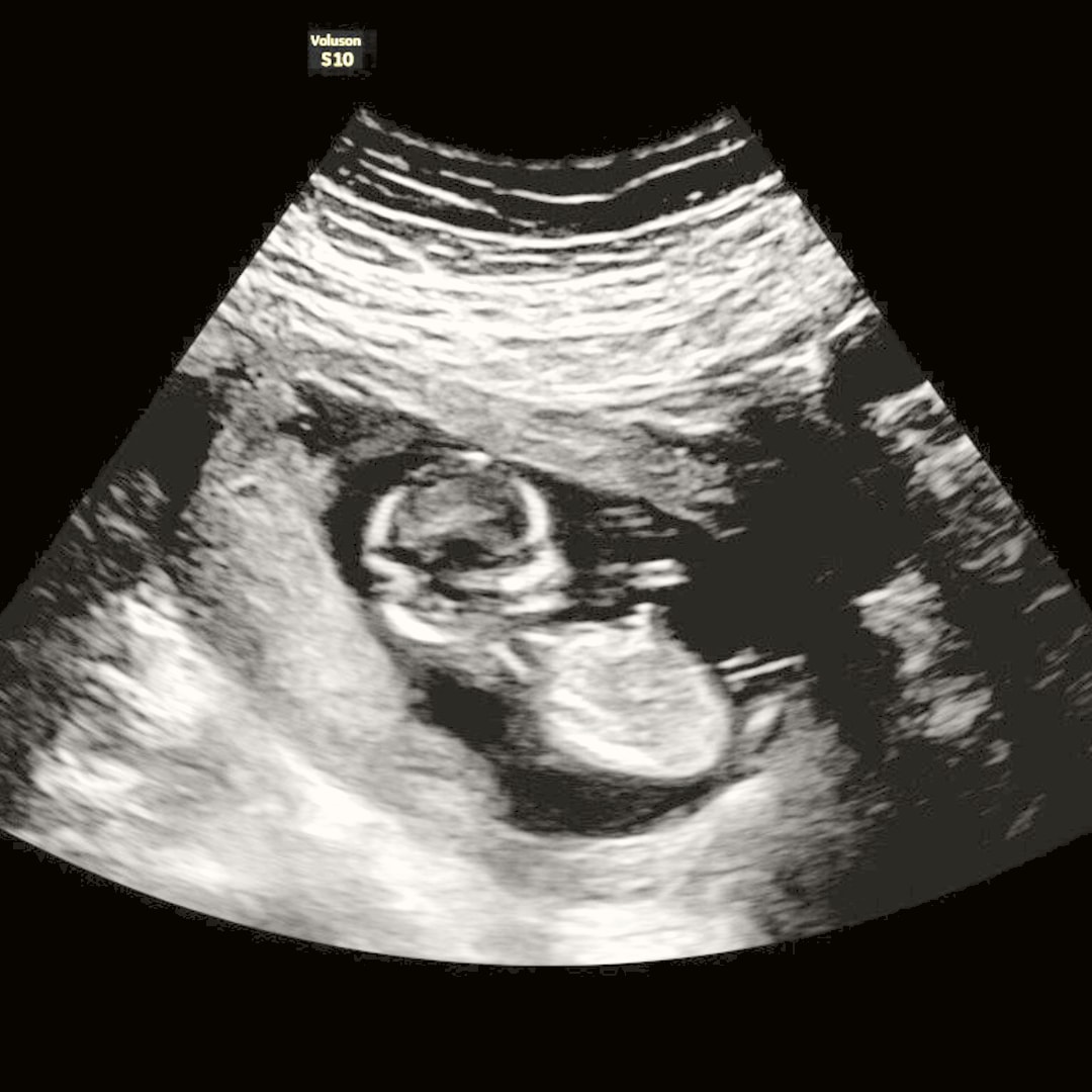 Photo shared by Arielle for their Babylist baby registry.