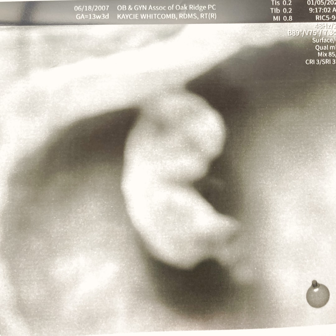 Photo shared by Gracie for their Babylist baby registry.