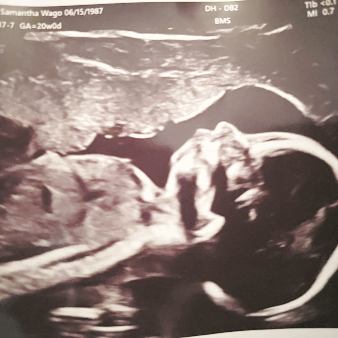 Photo shared by Samantha for their Babylist baby registry.