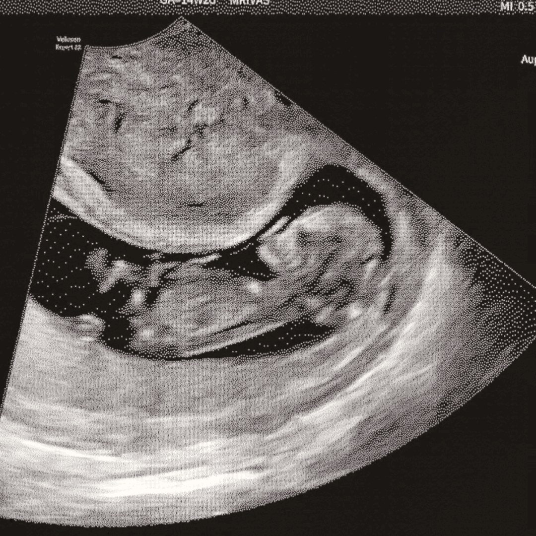 Photo shared by Andria for their Babylist baby registry.