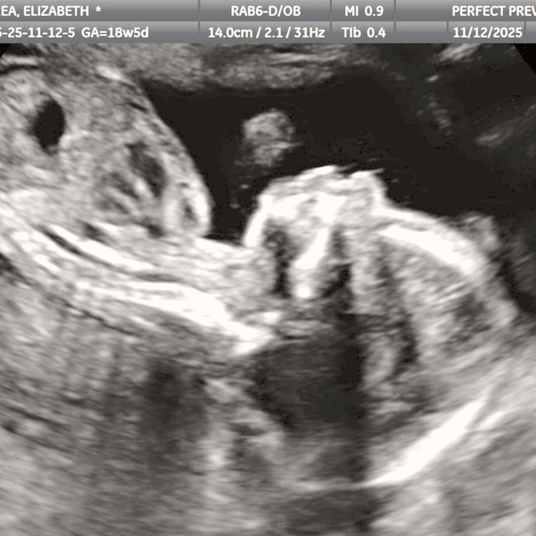 Photo shared by Elizabeth for their Babylist baby registry.