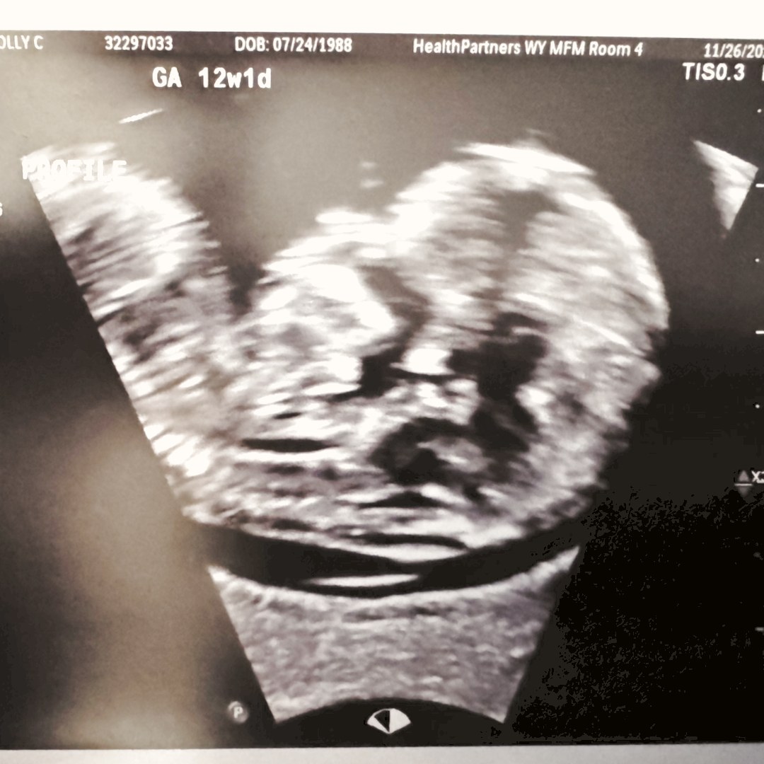 Photo shared by Molly for their Babylist baby registry.