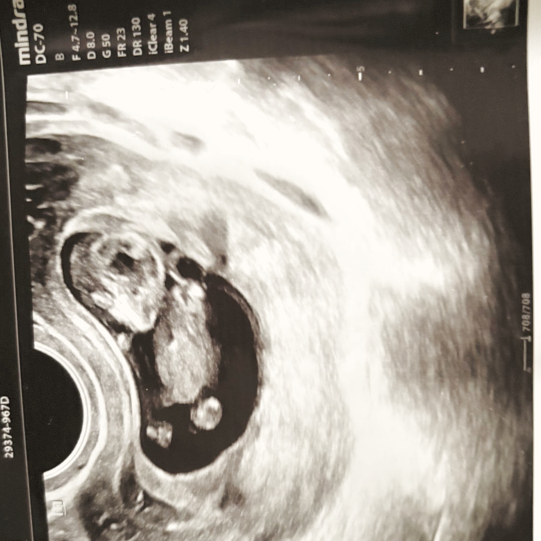 Photo shared by Denijah for their Babylist baby registry.