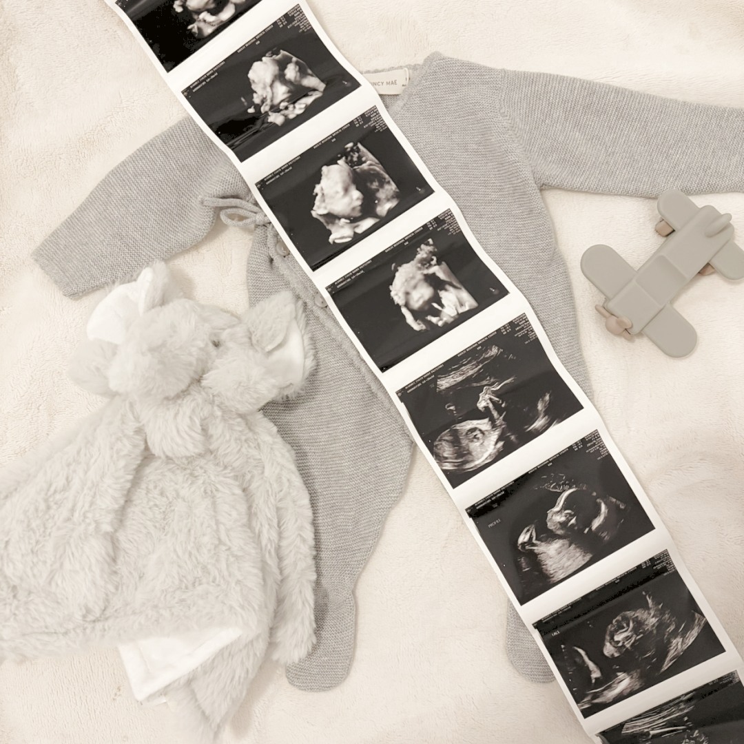 Photo shared by Chloe for their Babylist baby registry.