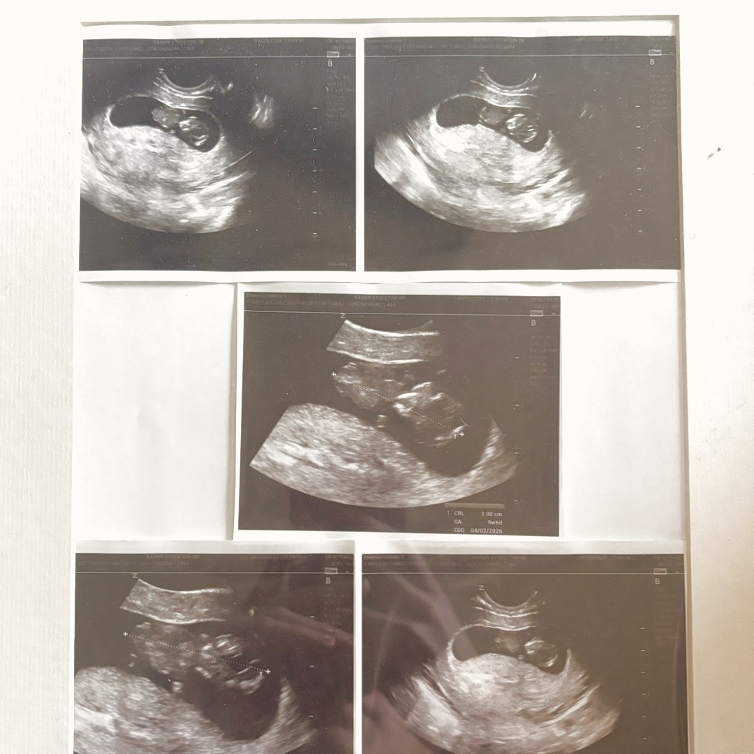 Photo shared by Bella for their Babylist baby registry.