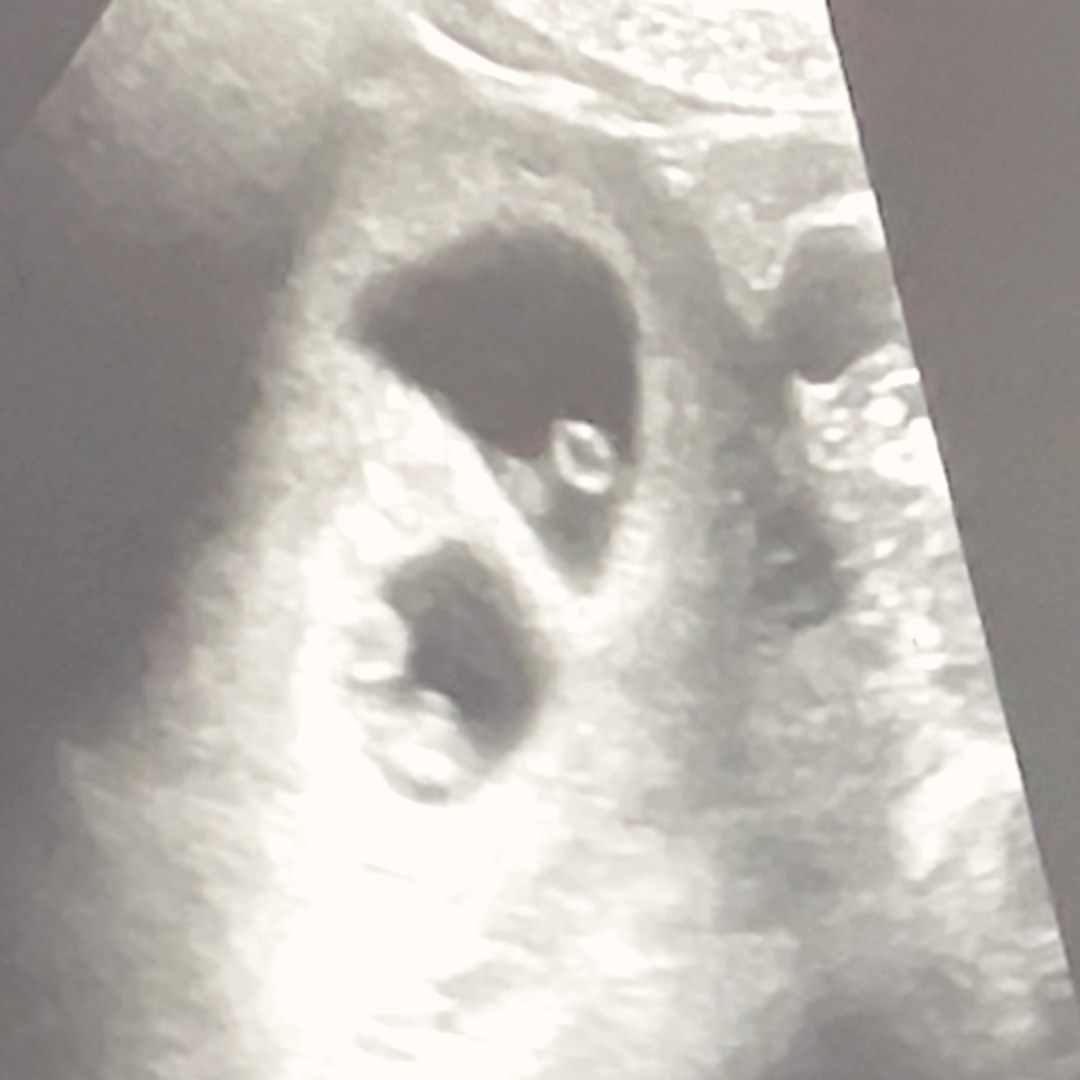 Photo shared by Reagan for their Babylist baby registry.