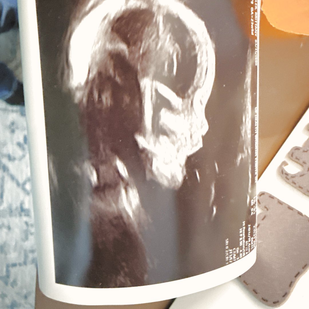 Photo shared by Brittany for their Babylist baby registry.