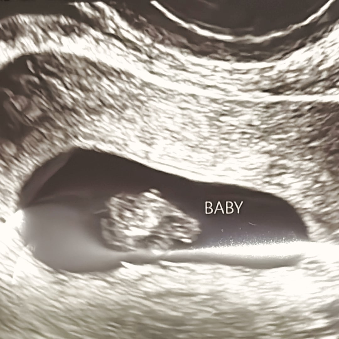 Photo shared by Eulalia for their Babylist baby registry.