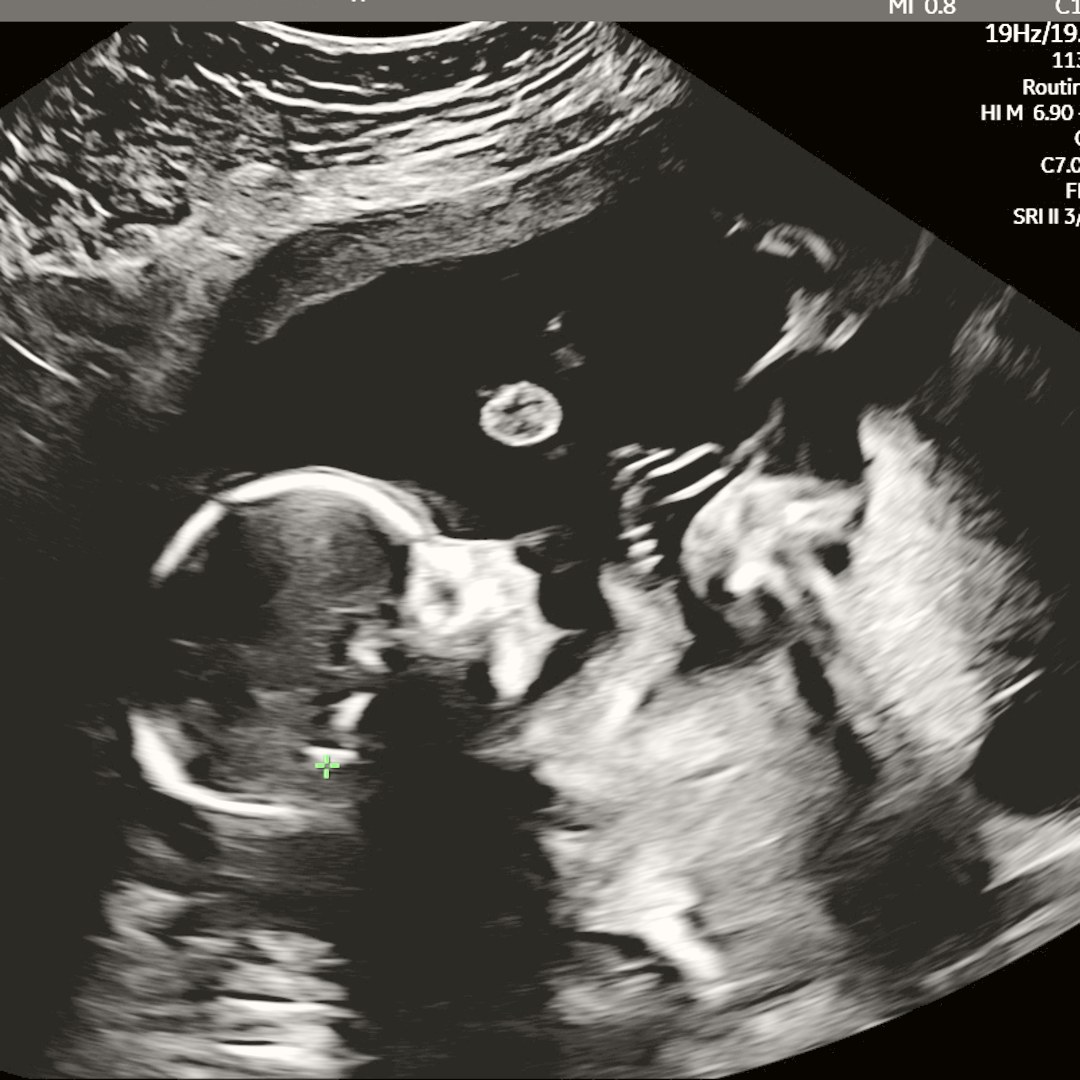 Photo shared by Jayde for their Babylist baby registry.