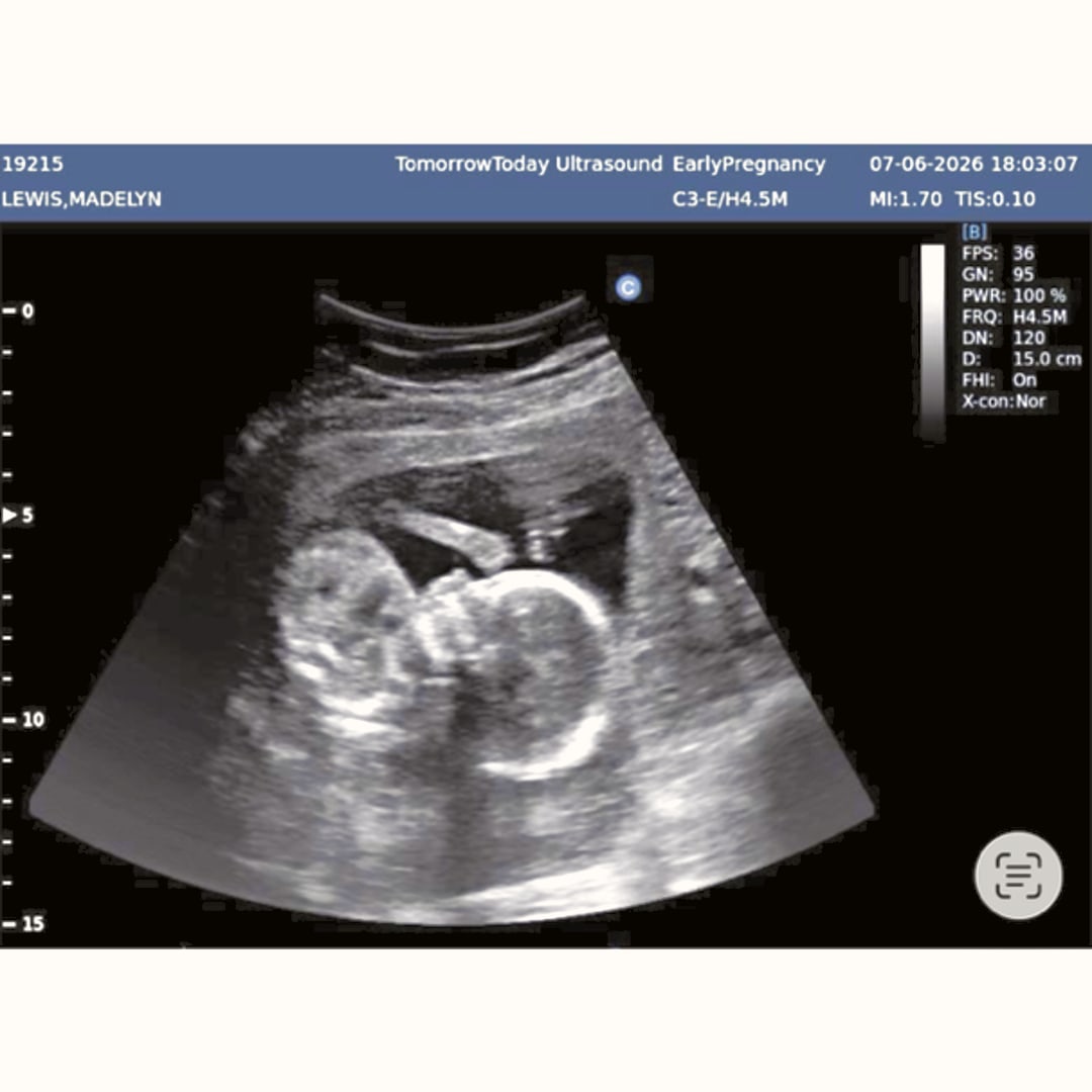 Photo shared by Madelyn for their Babylist baby registry.