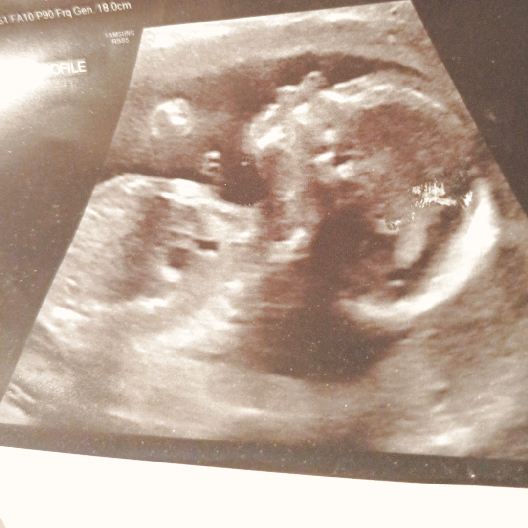 Photo shared by Zoe for their Babylist baby registry.