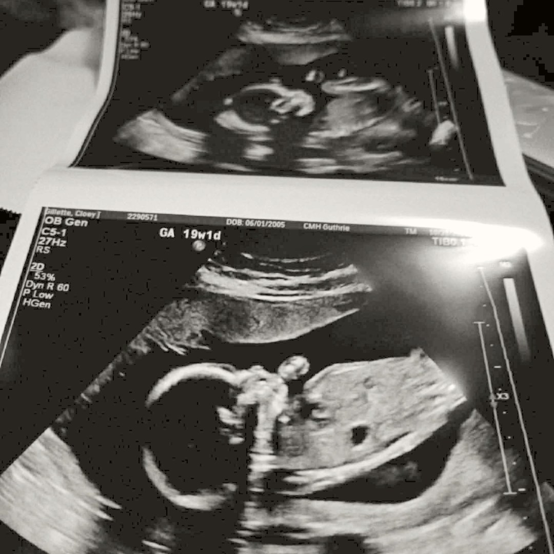 Photo shared by Cloey for their Babylist baby registry.