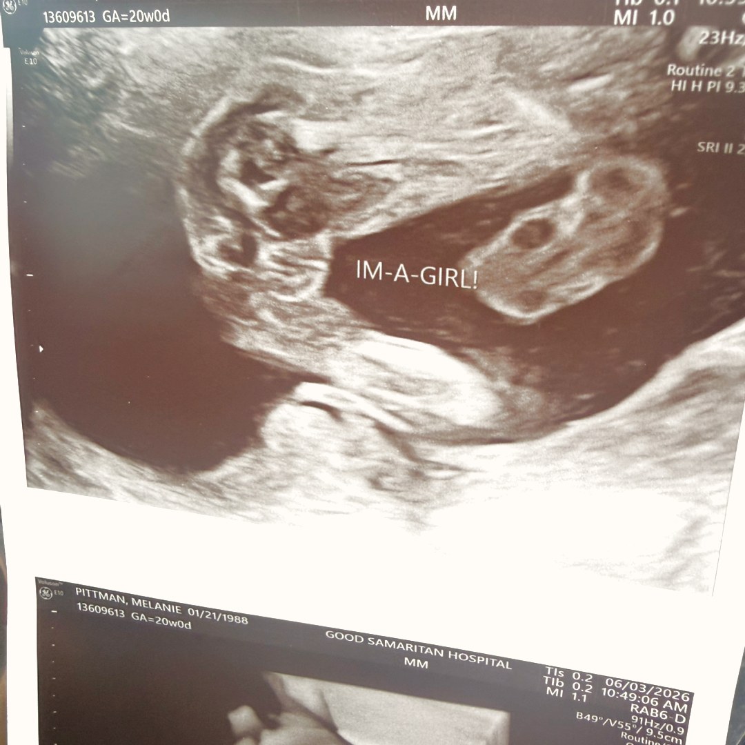 Photo shared by Melanie for their Babylist baby registry.