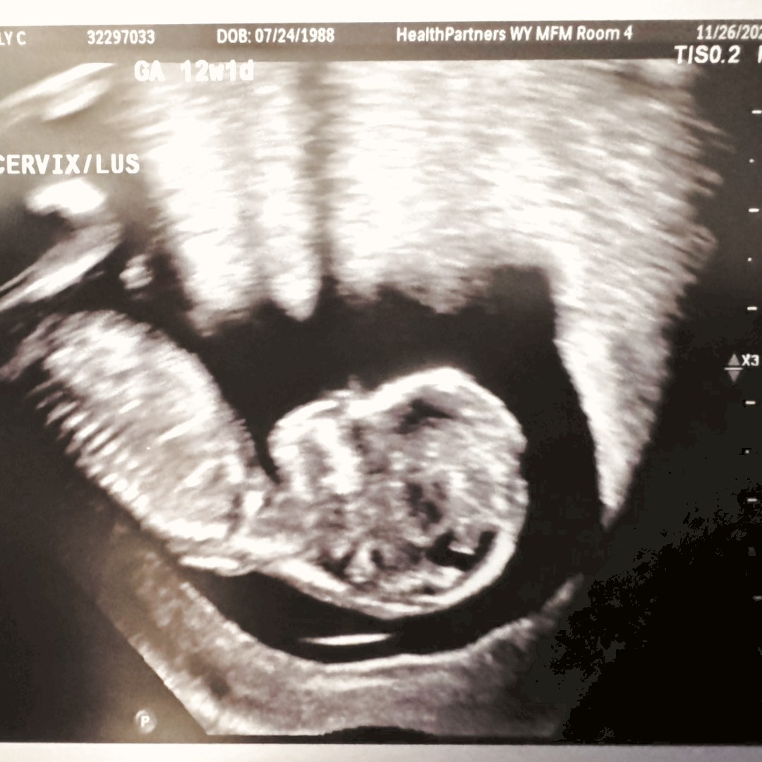 Photo shared by Molly for their Babylist baby registry.