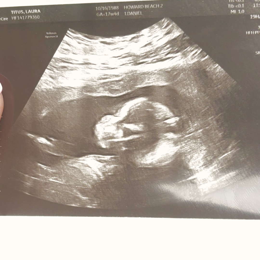Photo shared by Laura for their Babylist baby registry.