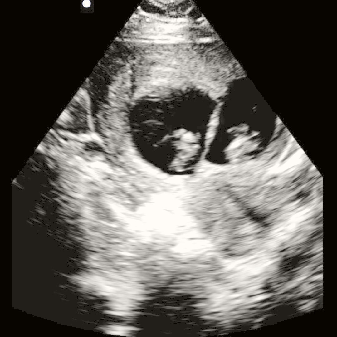 Photo shared by Hailey for their Babylist baby registry.