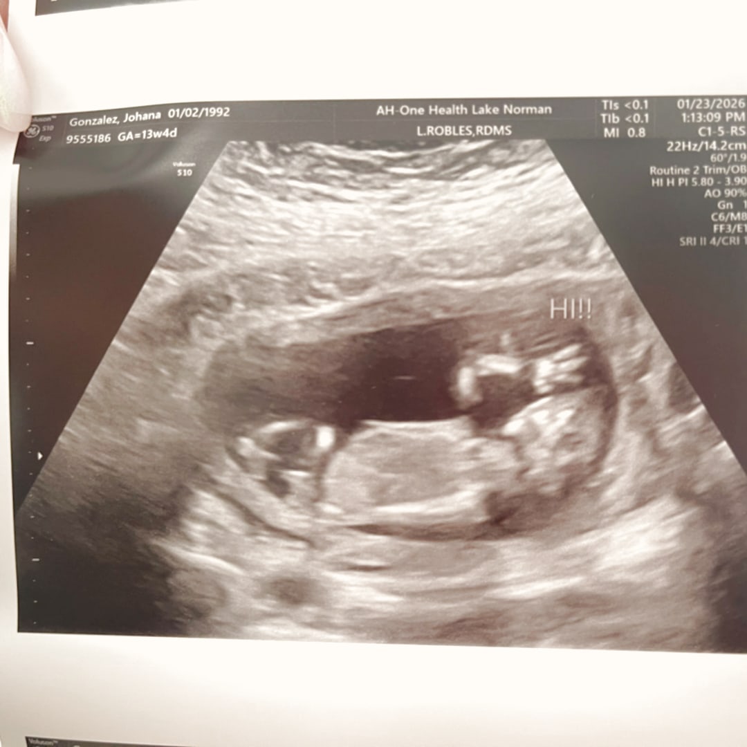 Photo shared by Johana for their Babylist baby registry.