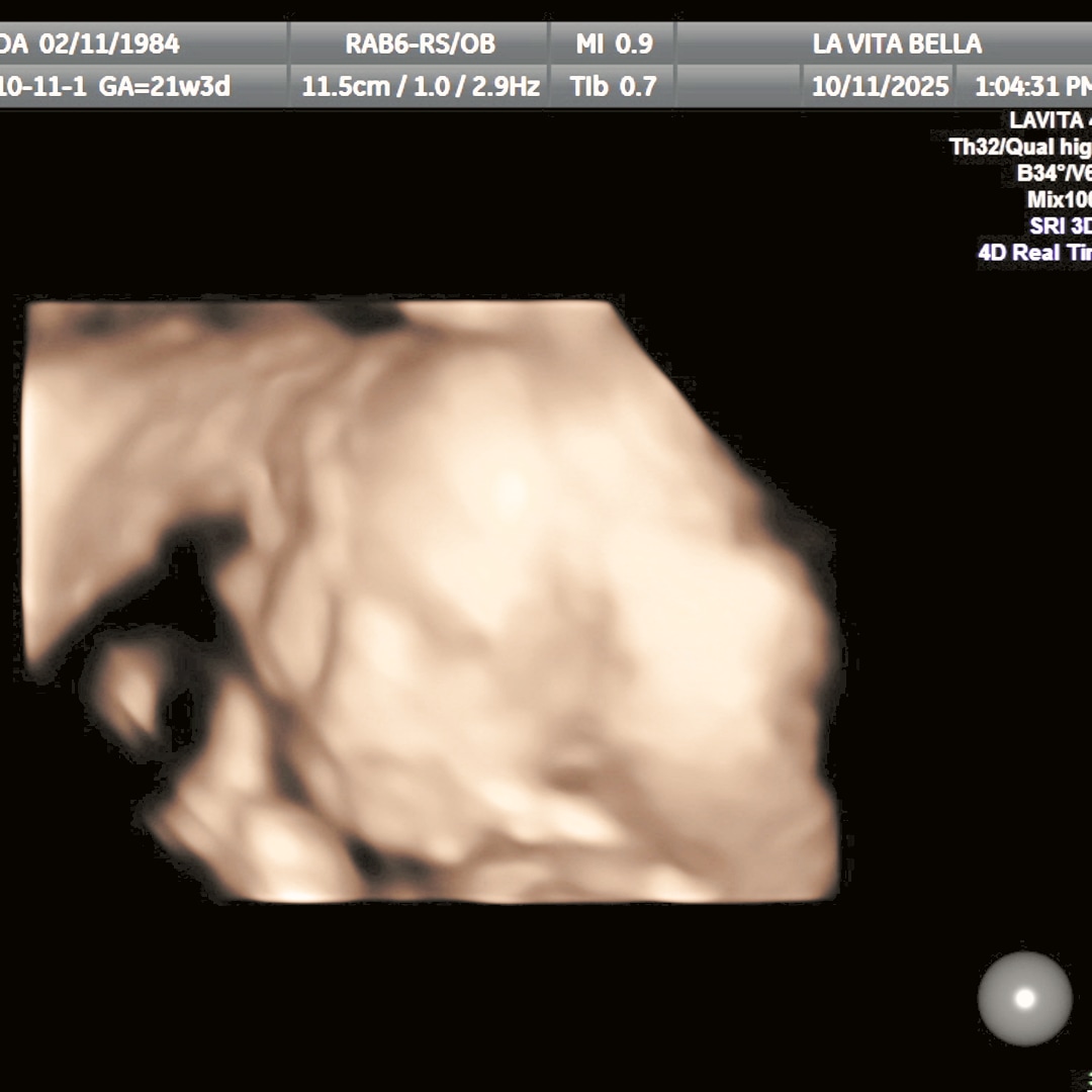 Photo shared by LaWanda for their Babylist baby registry.