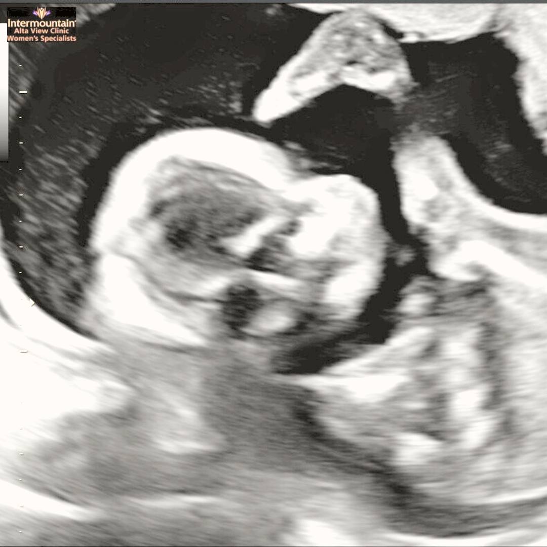 Photo shared by Brit for their Babylist baby registry.