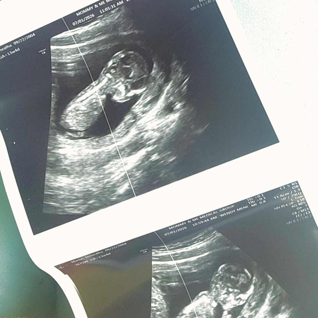 Photo shared by Duckey for their Babylist baby registry.