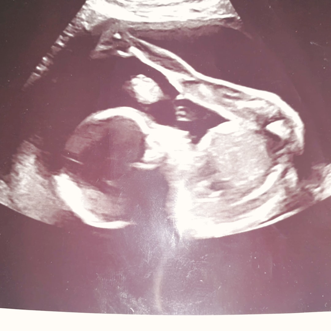 Photo shared by Erika for their Babylist baby registry.