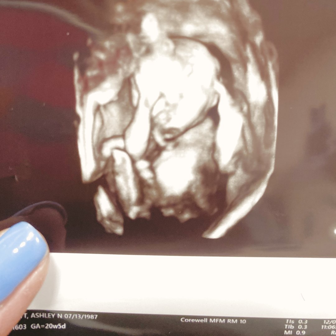 Photo shared by Ashley for their Babylist baby registry.