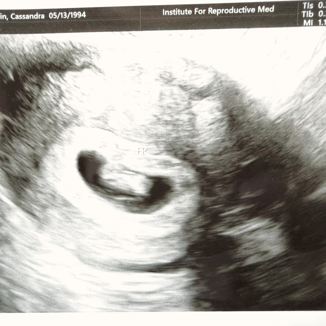 Photo shared by Cassandra for their Babylist baby registry.