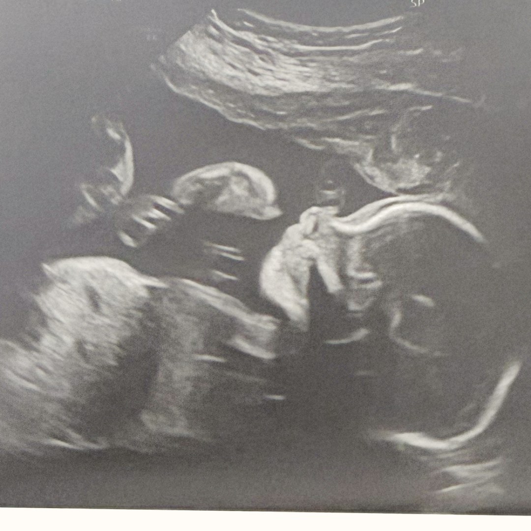 Photo shared by Emily for their Babylist baby registry.