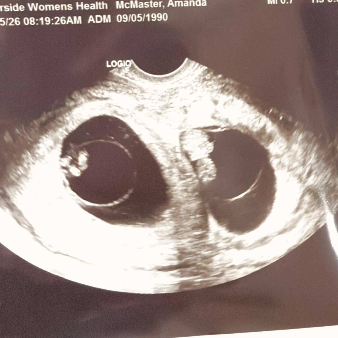 Photo shared by Amanda for their Babylist baby registry.