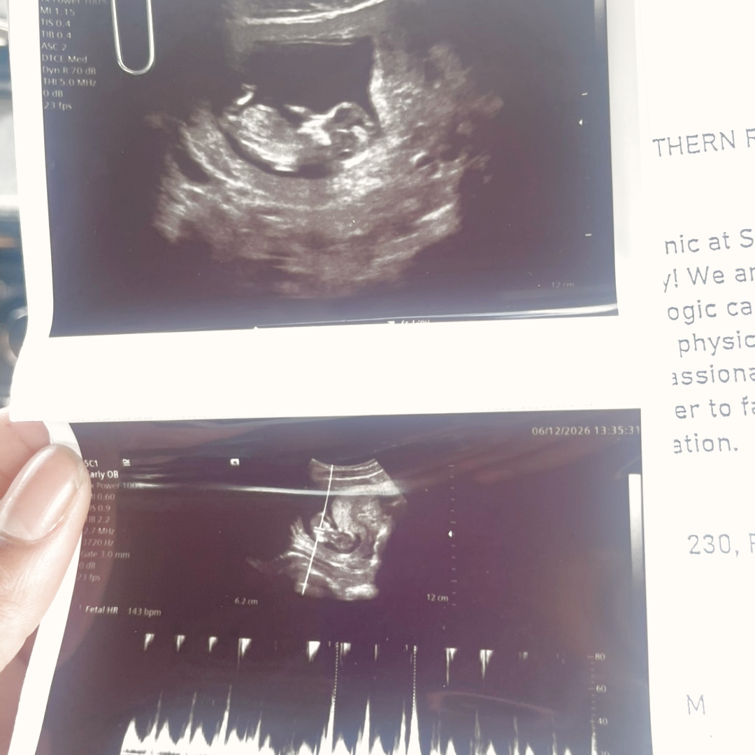 Photo shared by Dajana for their Babylist baby registry.