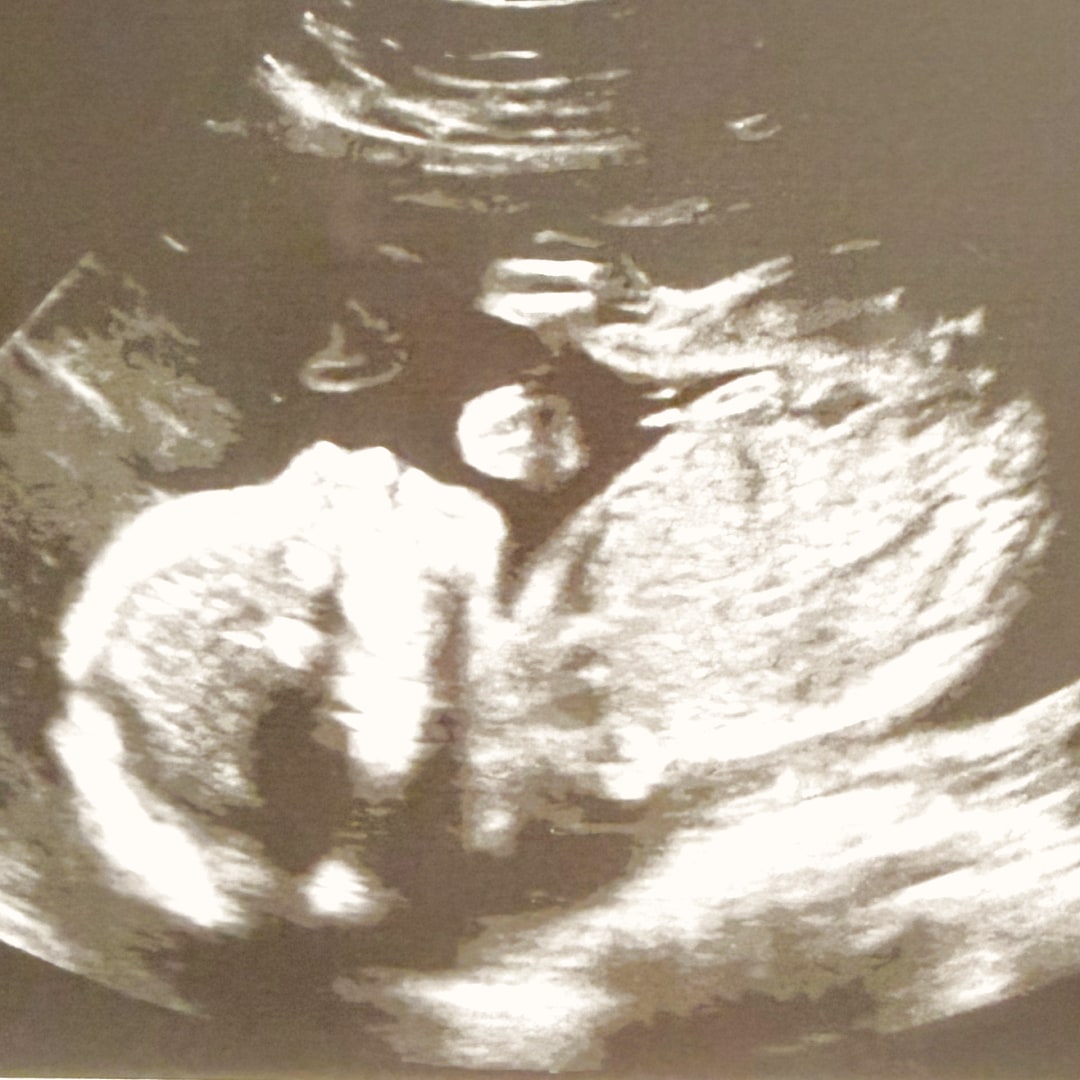 Photo shared by Harley for their Babylist baby registry.