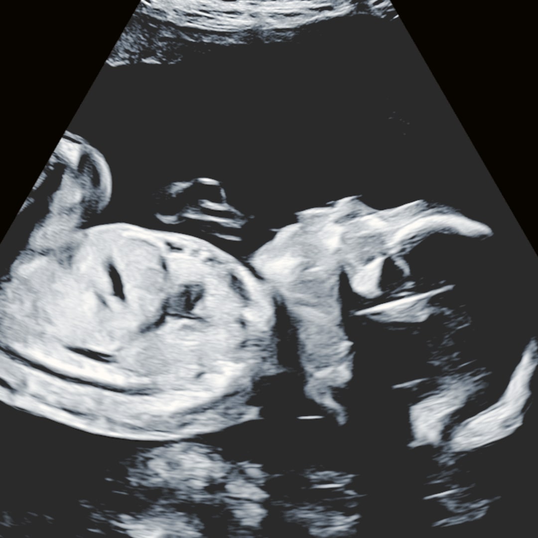 Photo shared by Emma for their Babylist baby registry.