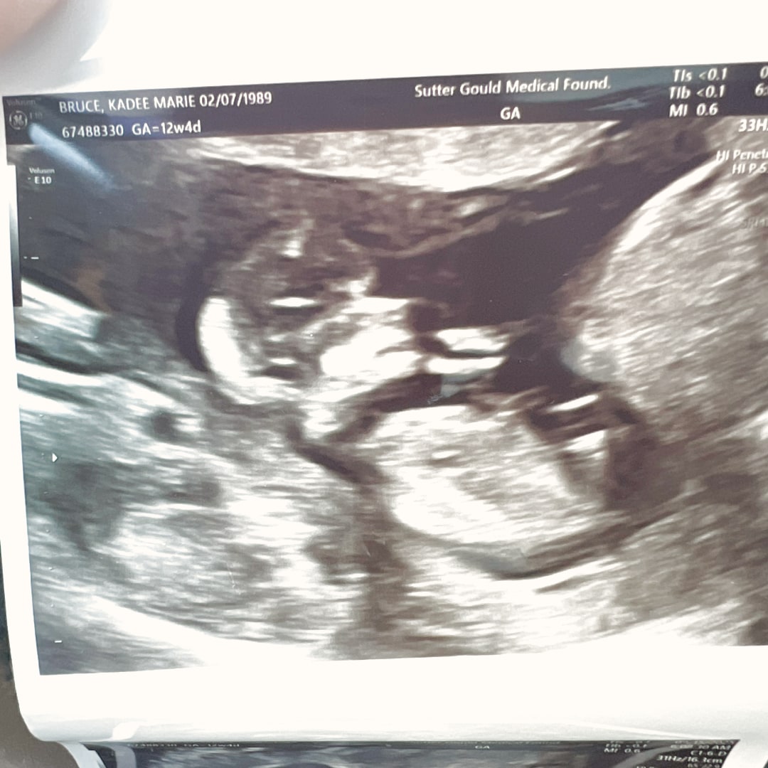 Photo shared by Kadee for their Babylist baby registry.