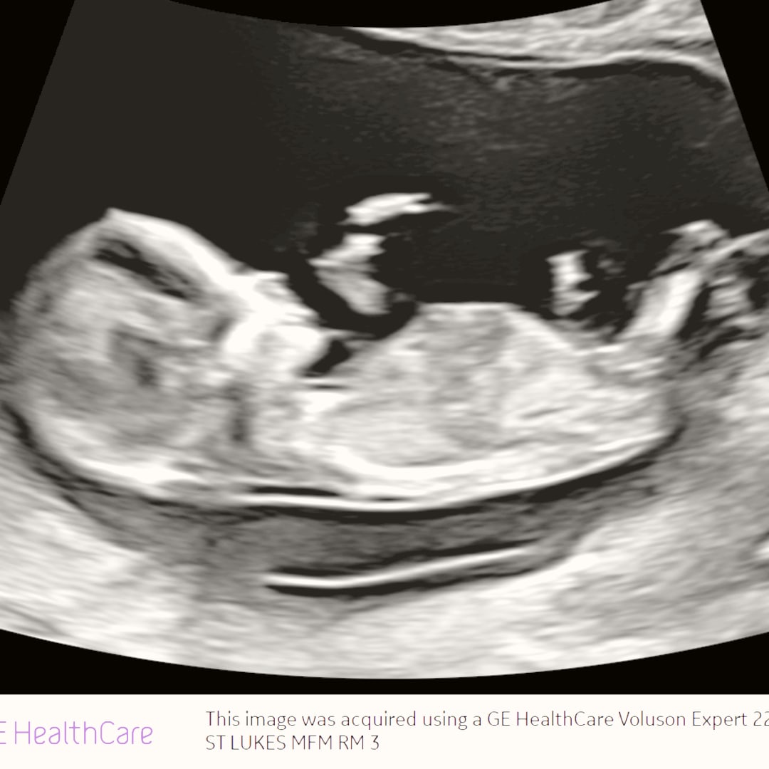 Photo shared by Amanda for their Babylist baby registry.