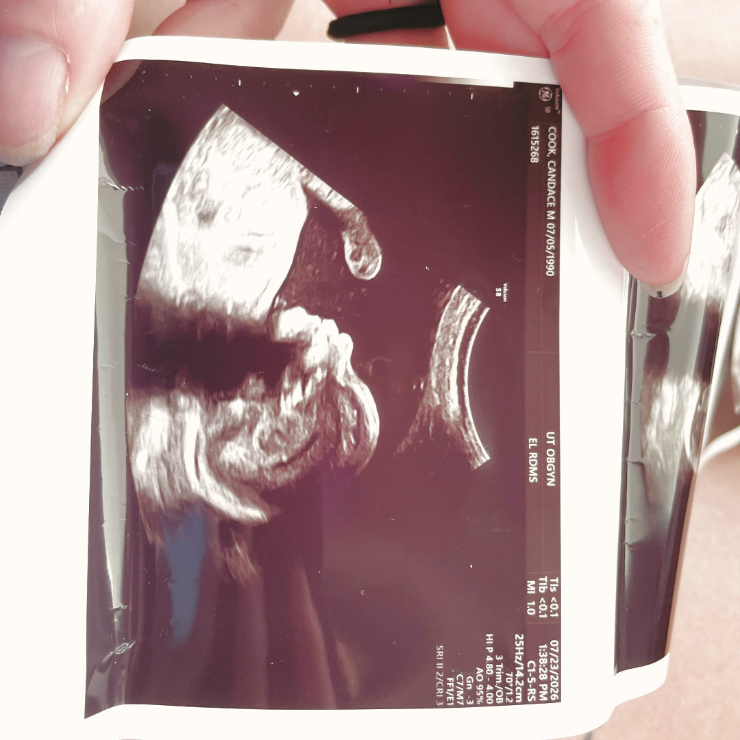 Photo shared by Candace for their Babylist baby registry.