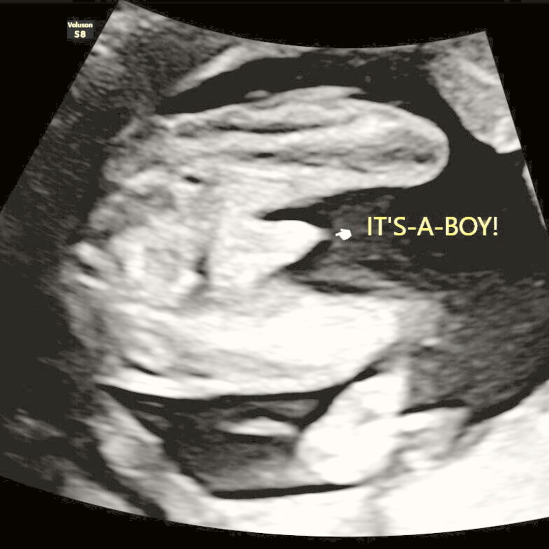 Photo shared by Mariana for their Babylist baby registry.