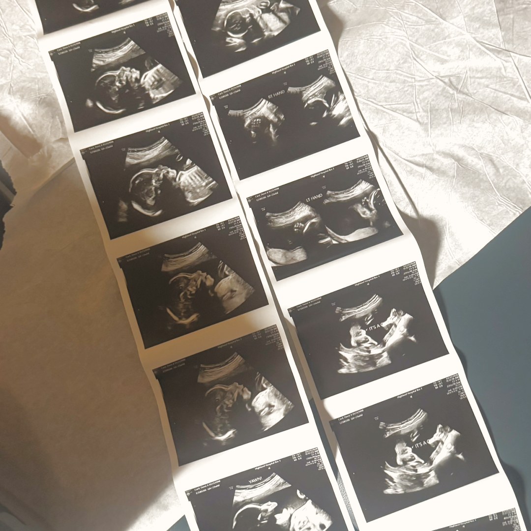 Photo shared by Demi for their Babylist baby registry.