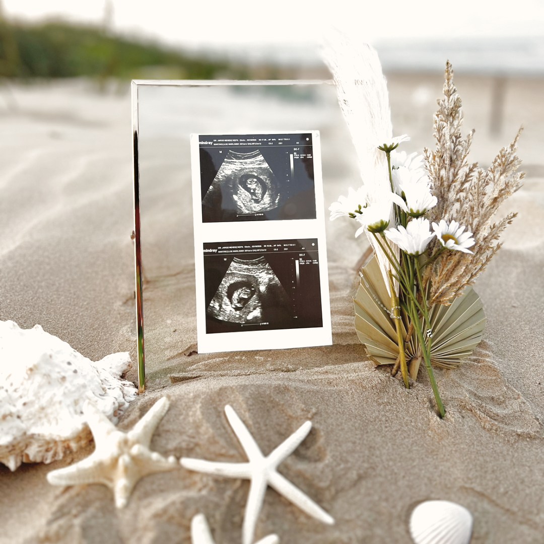 Photo shared by Ilse for their Babylist baby registry.