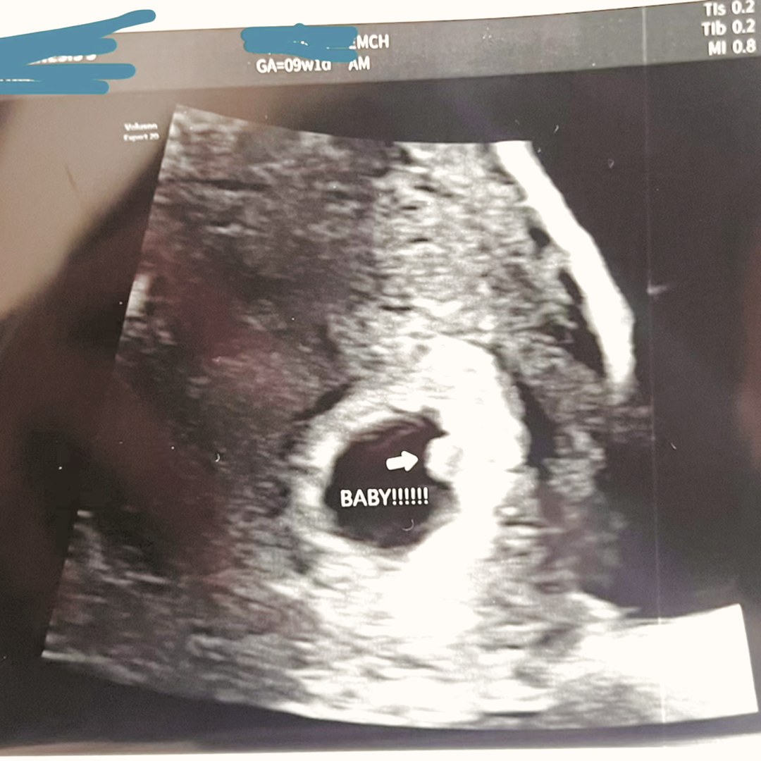 Photo shared by Oliver for their Babylist baby registry.
