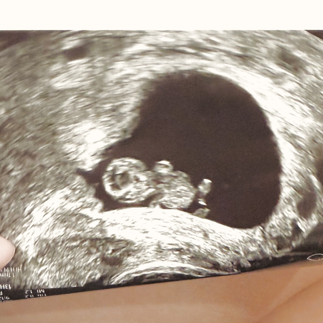 Photo shared by Brittanie for their Babylist baby registry.