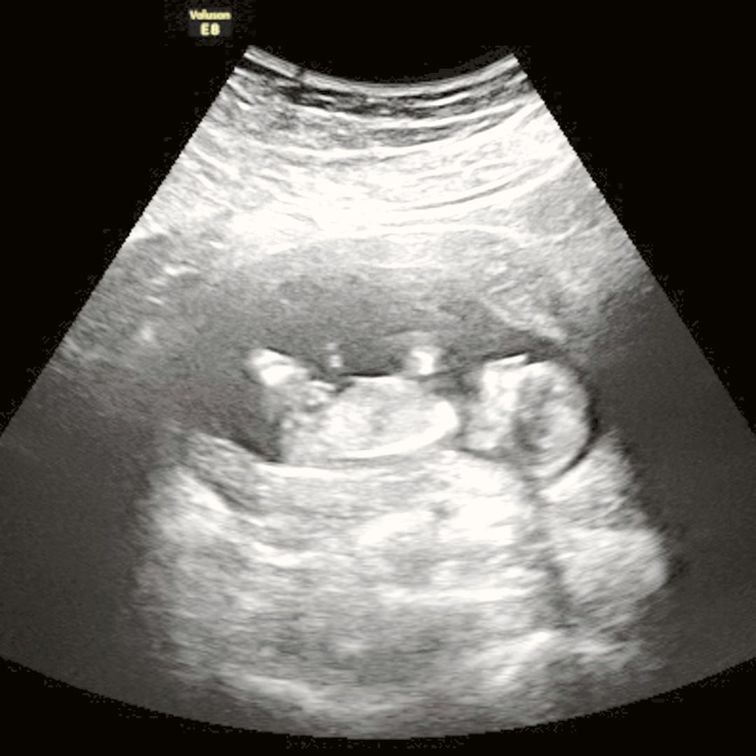 Photo shared by Kelby for their Babylist baby registry.