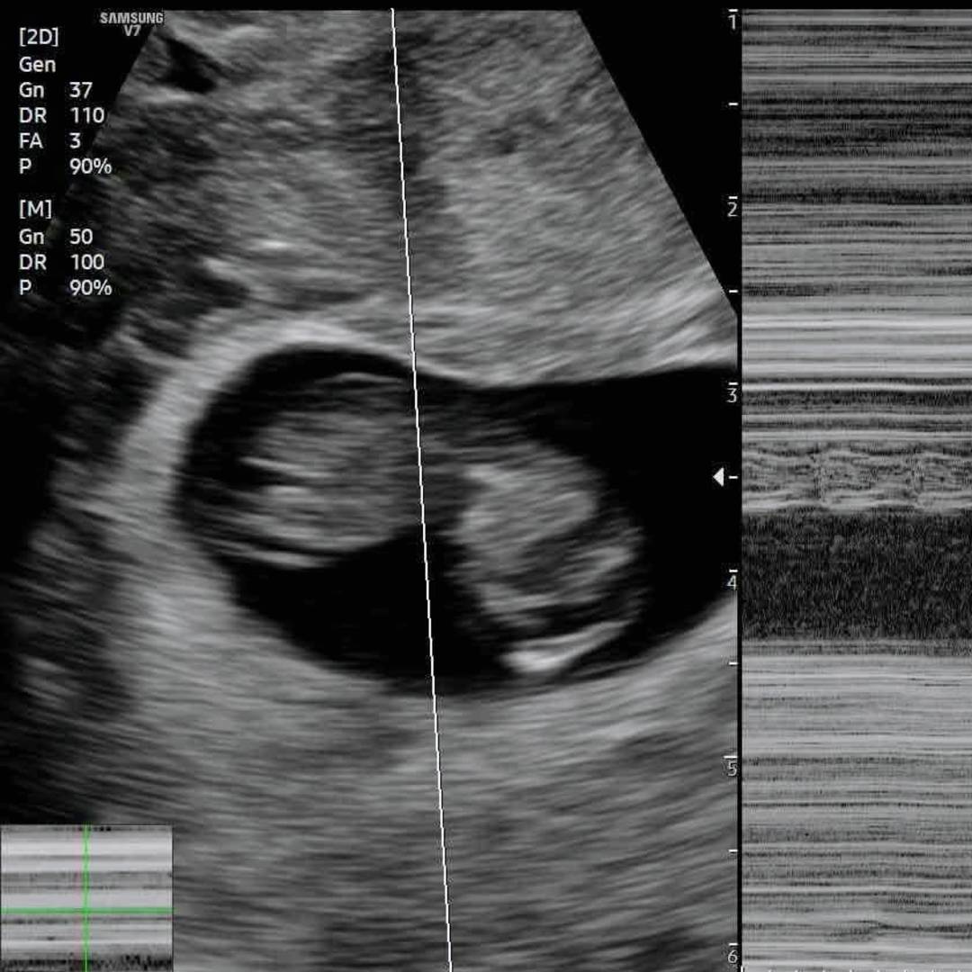 Photo shared by Savannah for their Babylist baby registry.